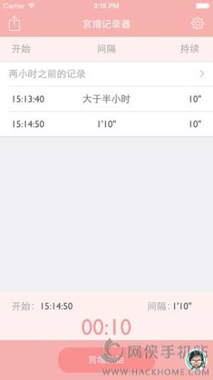 msӛAPPD2