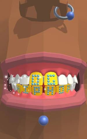 Dentist BlingϷͼ1