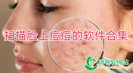 扫描脸上痘痘的软件合集